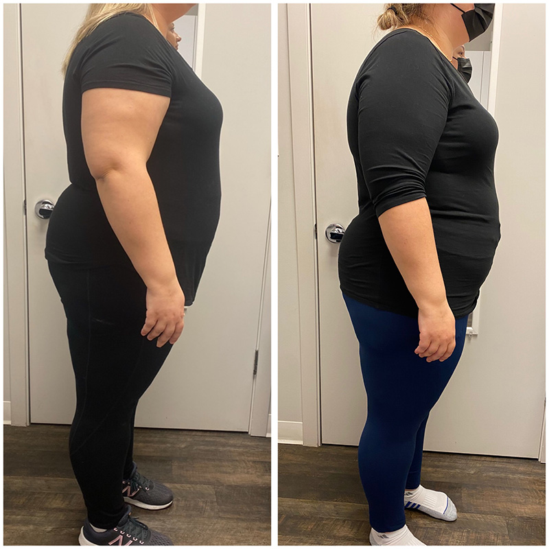 Dr. Polo's Medically Supervised Weight Loss Program - Before and After  Transformations