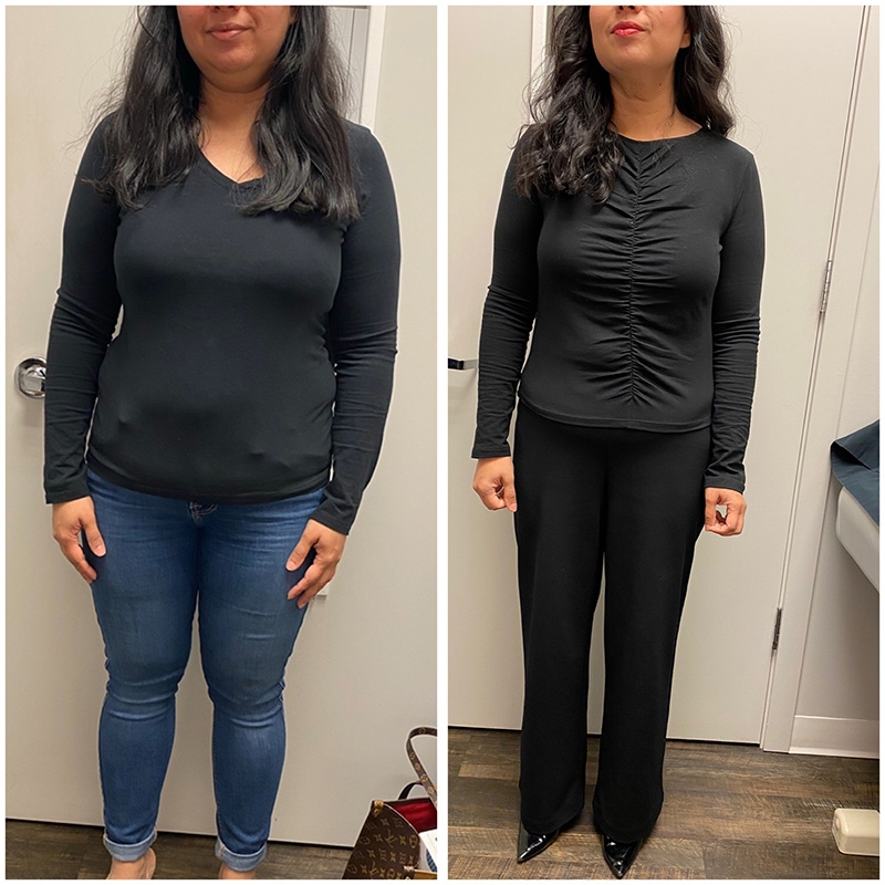 Dr. Polo's Medically Supervised Weight Loss Program - Before and After  Transformations